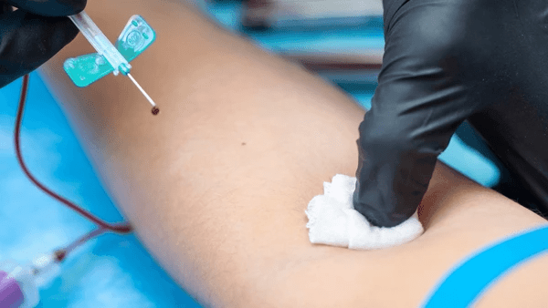 sterilisation-volontaire-temoignages-et-implications-de-ce-choix-de-vie