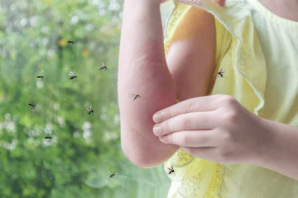 jeune fille faisant une allergie à une piqûre insecte
